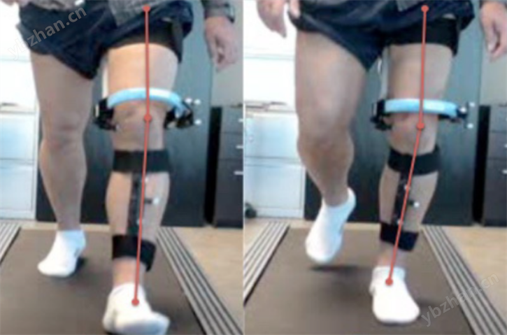 实时3D膝关节功能评估 Knee KG